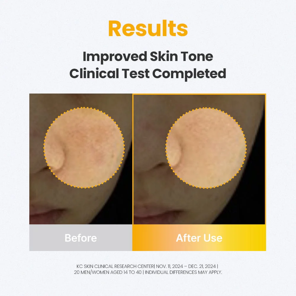 DR.G 3D VITAMIN C NIACINAMIDE 5% BOOSTER BRIGHTENING SERUM (30ML) - Image 5