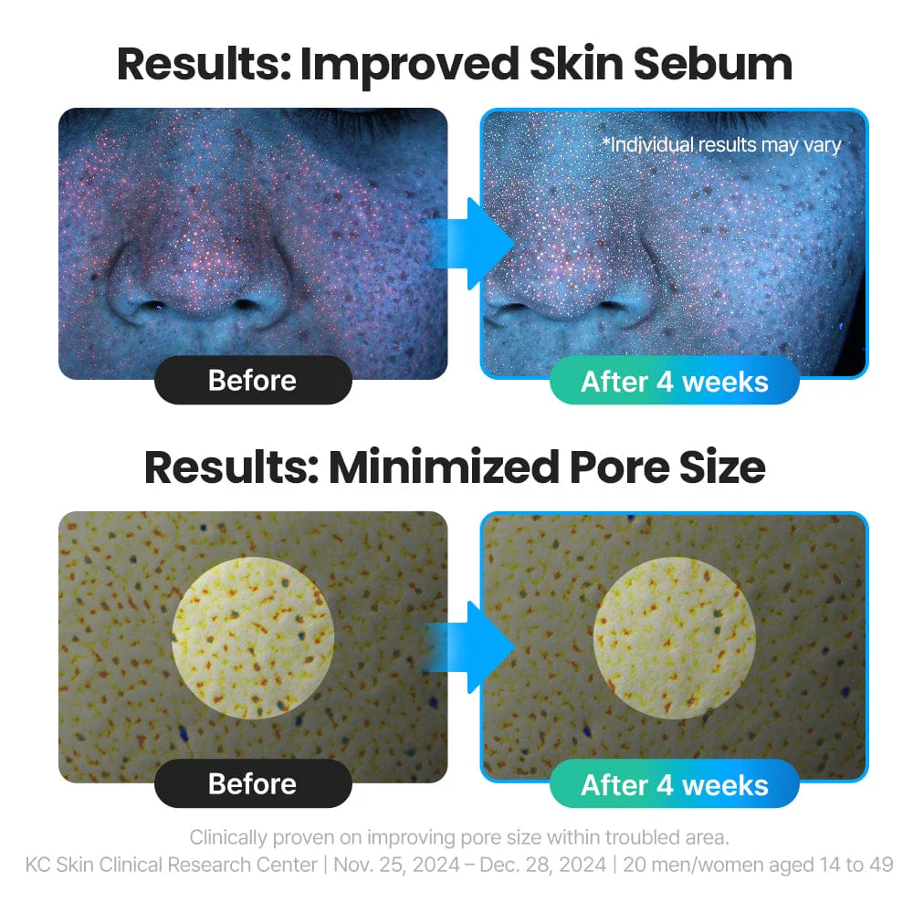 DR.G R.E.D BLEMISH CLEAR HYAL-CICA SOOTHING SERUM (50ML) - Image 9