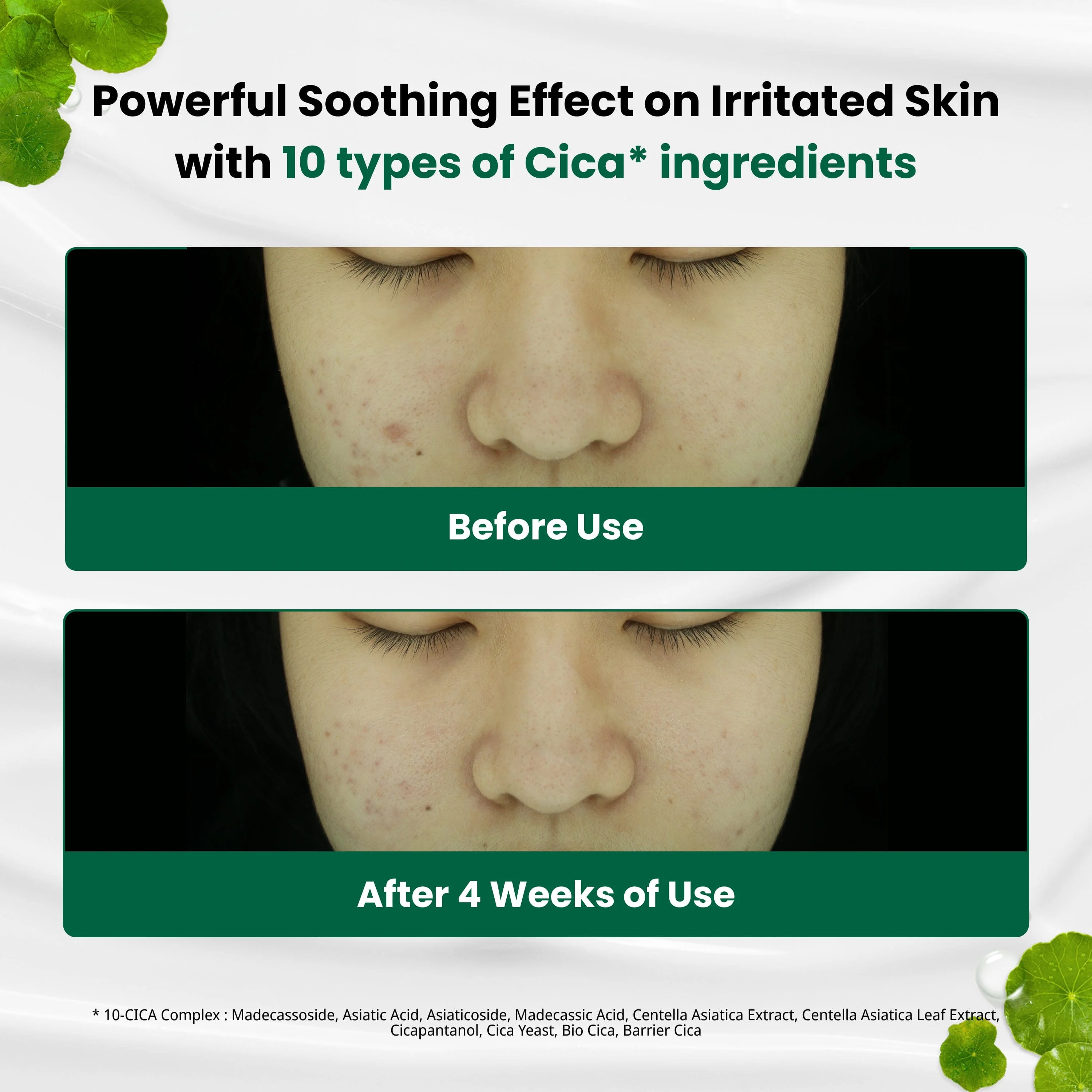 DR.G R.E.D BLEMISH CLEAR SOOTHING CREAM (70ML) - Image 4