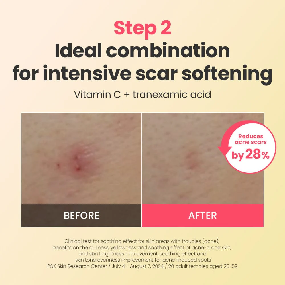 DR.G R.E.D BLEMISH REPAIR SOOTHING SERUM & CREAM DUO - Image 4