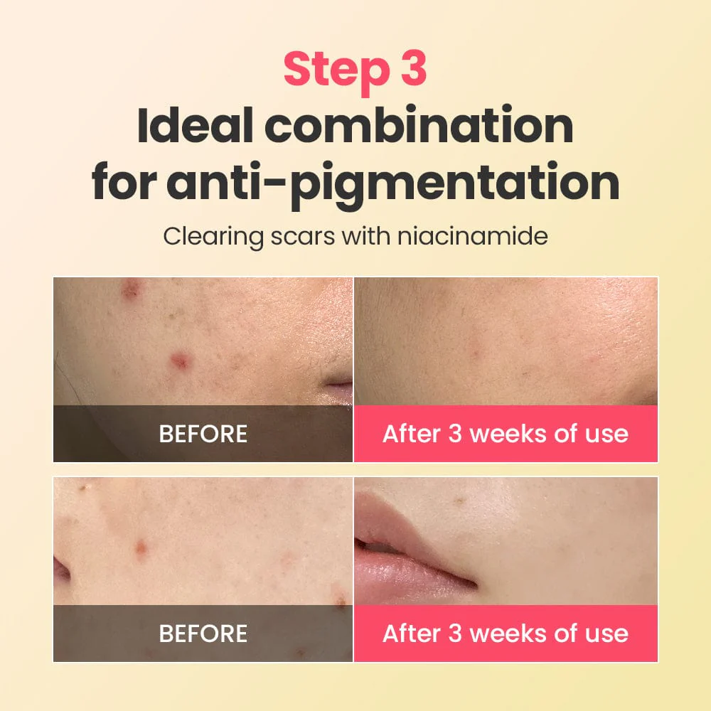 DR.G R.E.D BLEMISH REPAIR SOOTHING SERUM & CREAM DUO - Image 5