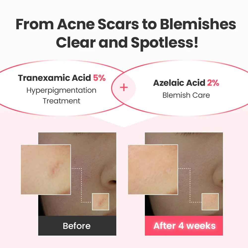 DR.G R.E.D BLEMISH TXA REPAIR SERUM (30ML) - Image 4