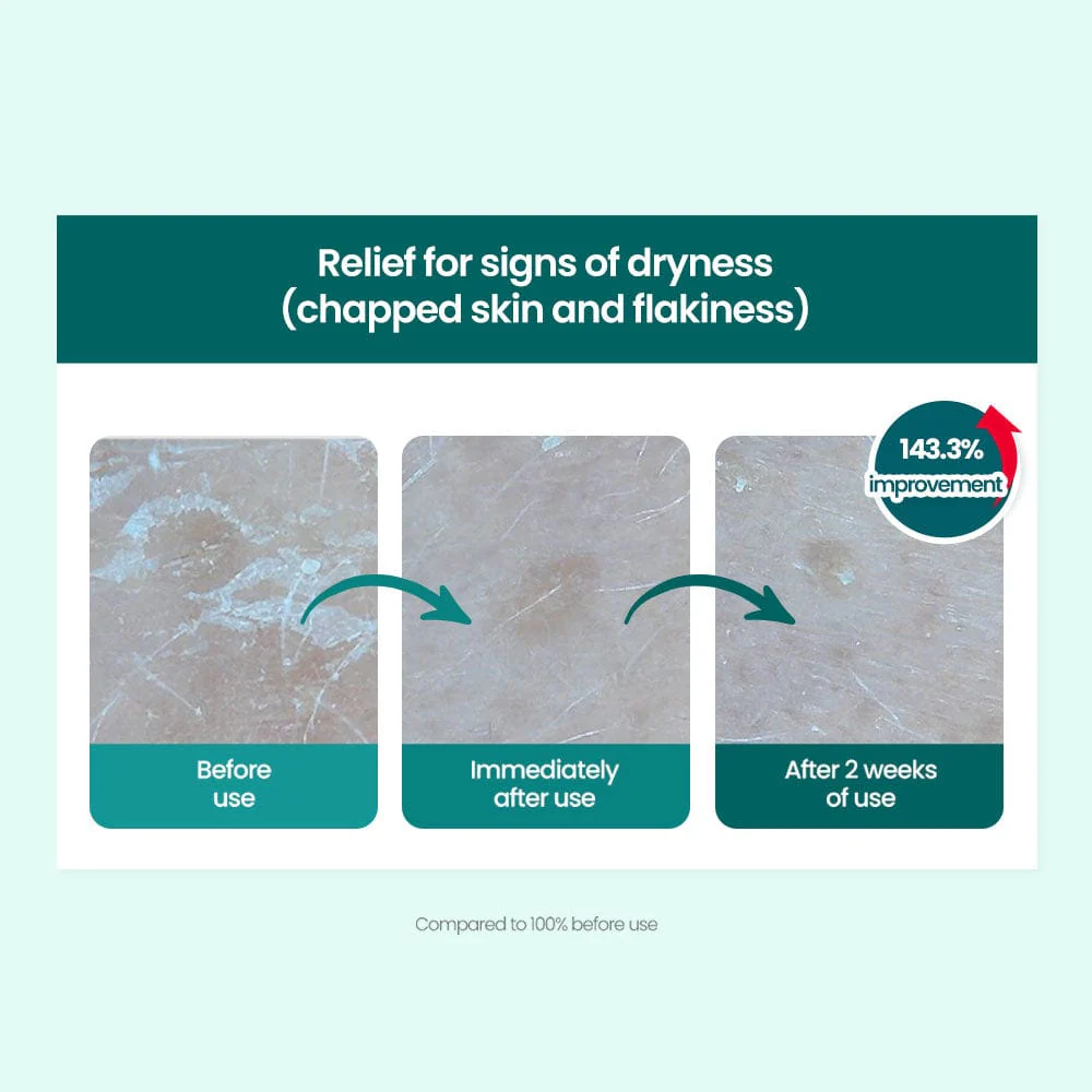 DR.G R.E.D BLEMISH CLEAR MOISTURE CREAM (70ML) - Image 7