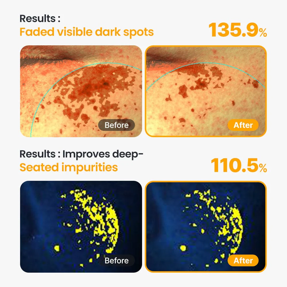 DR.G VITA CLEAR SUN SERUM 50ML - Image 6