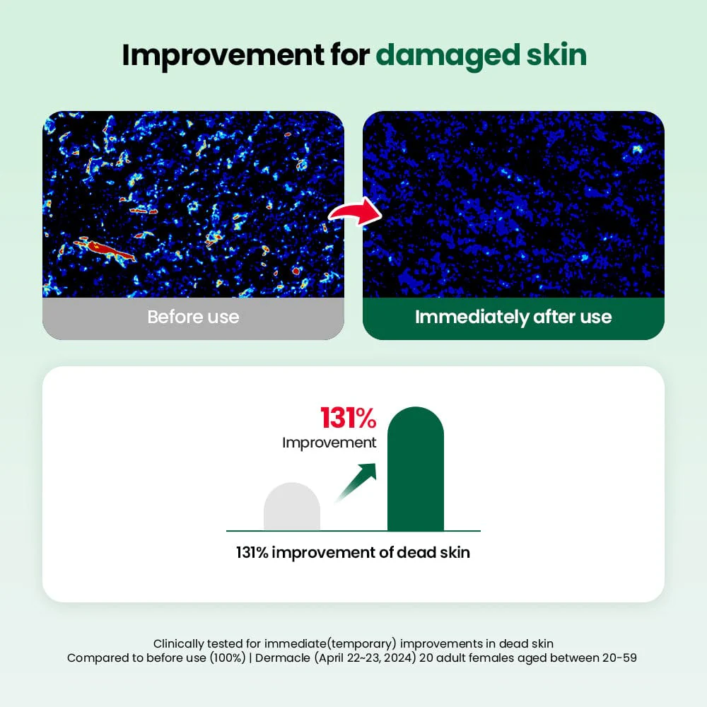 Dr.G RED Blemish Clear Double Soft Pads (60 pads) - Image 6